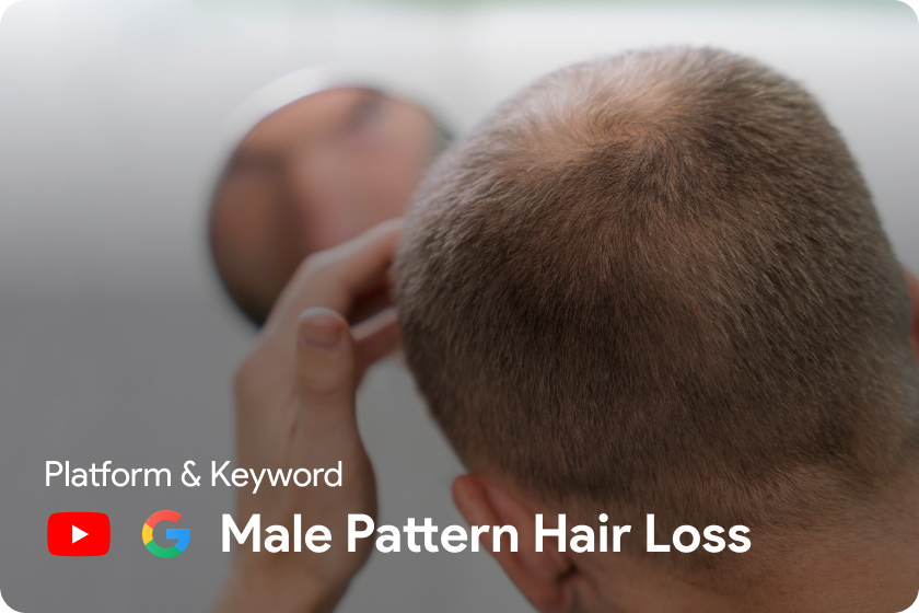 Male Hair Loss